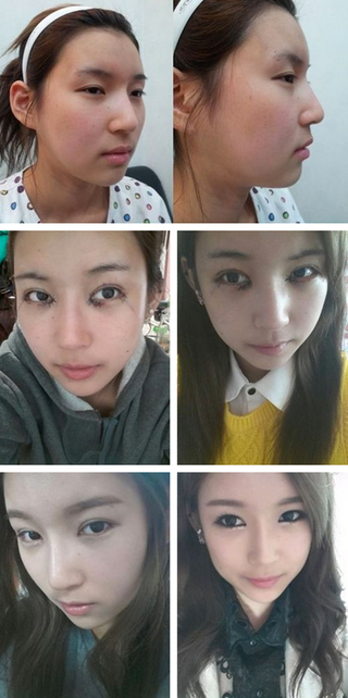 Illustration for article titled I Can't Stop Looking at These South Korean Women Who've Had Plastic Surgery